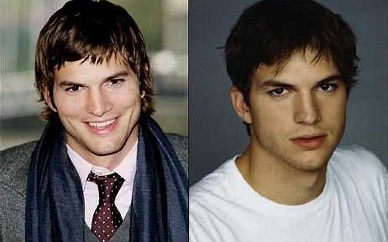 Ashton Kutcher Facelift