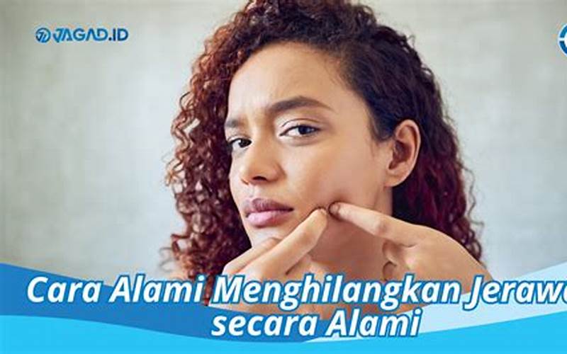 Atasi Jerawat Dengan Cara Alami Dan Aman