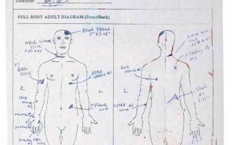 Autopsy Report Findings