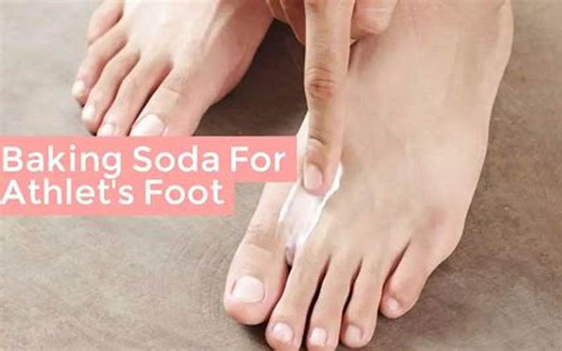 Baking Soda And Athlete'S Foot