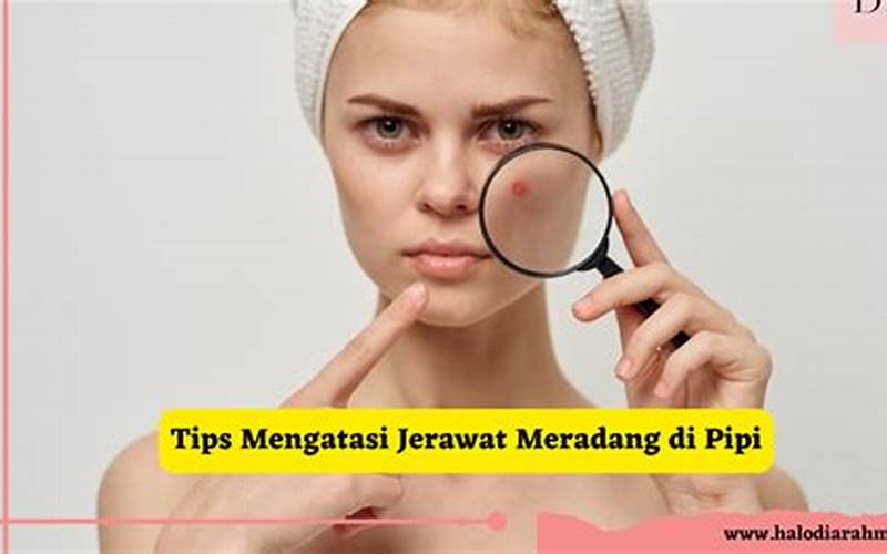 Bekas Jerawat Meradang Di Pipi: Cara Mengatasi Dan Mencegahnya