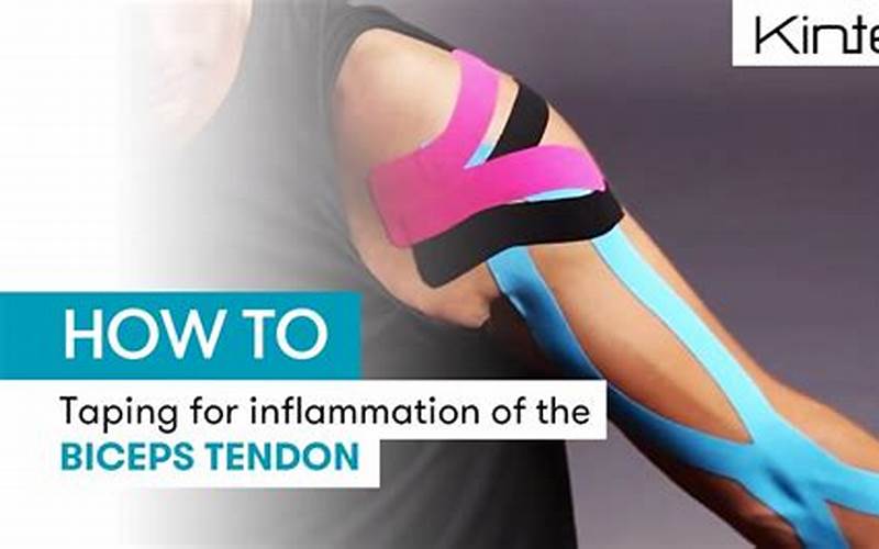 Bicep Tendonitis KT Tape: An Effective Treatment for Arm Pain