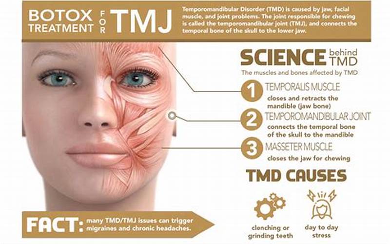 Botox For Tmj Procedure