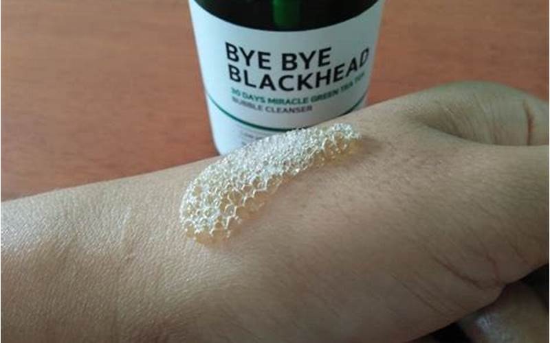 Bye Bye Blackhead, Solusi Ampuh Mengatasi Jerawat