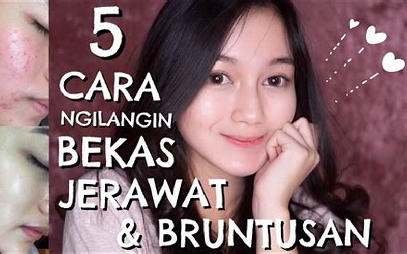 Cara Alami Menghilangkan Jerawat Dan Bruntusan