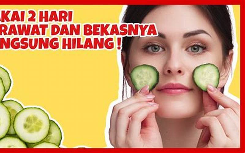 Cara Memakai Mentimun Untuk Menghilangkan Jerawat