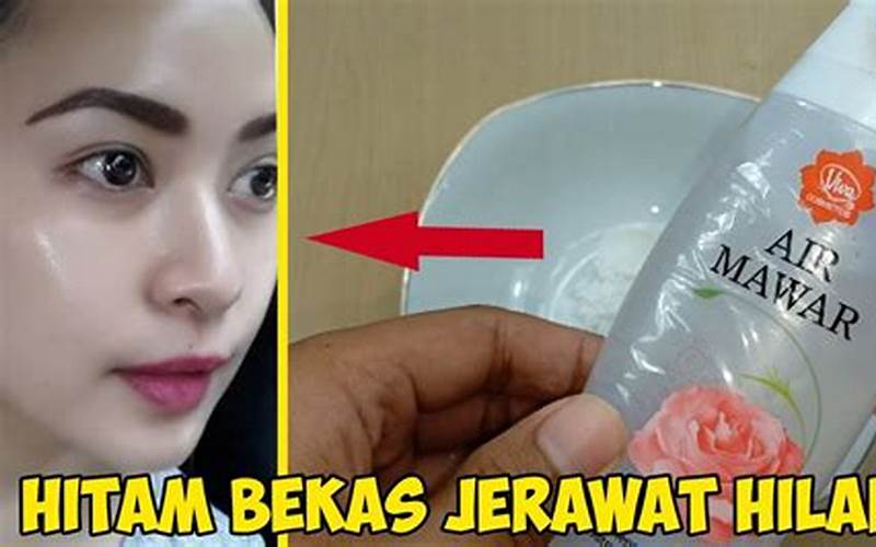 Cara Membersihkan Wajah Dari Bekas Jerawat