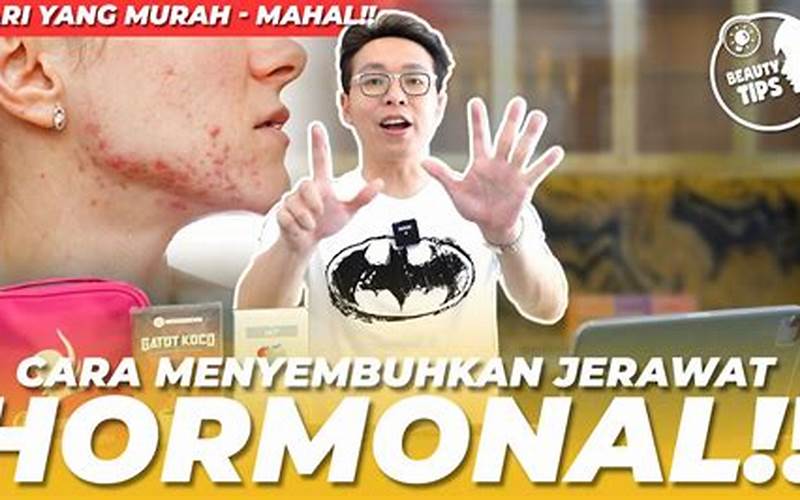 Cara Mengatasi Jerawat Hormon