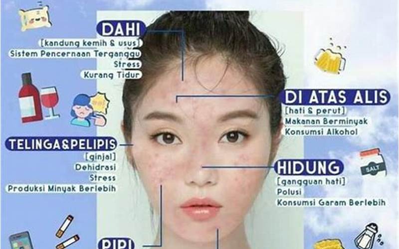 Cara Menghilangkan Jerawat Di Kening