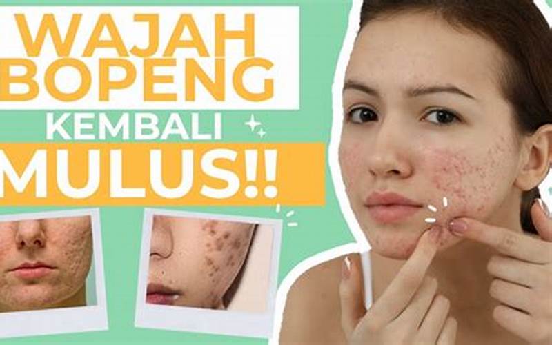 Cara Menghilangkan Lubang Bekas Jerawat Di Muka