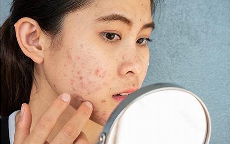 Cari Facial Wash Drugstore Yang Tepat Untuk Mengatasi Bekas Jerawat?