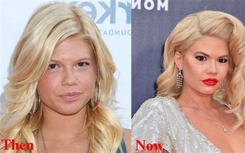 Chanel West Coast Before And After