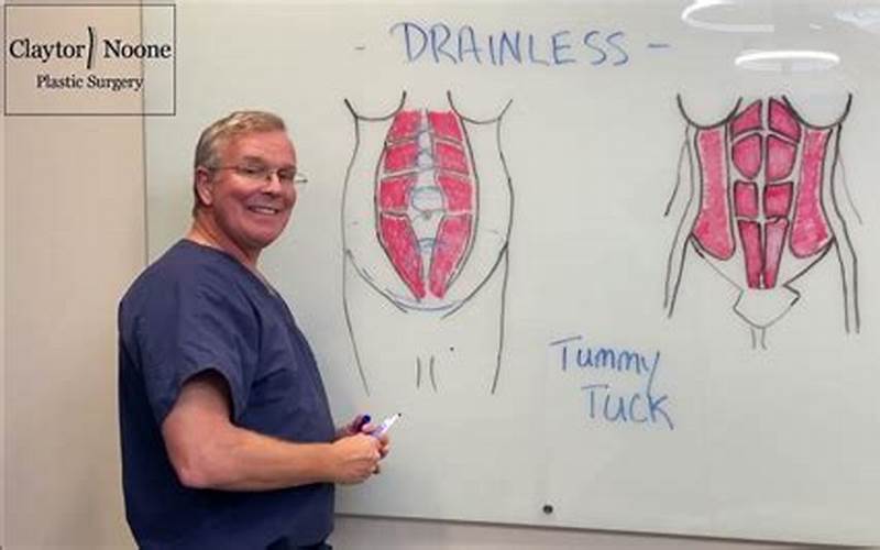 Disadvantages Of Drainless Tummy Tuck