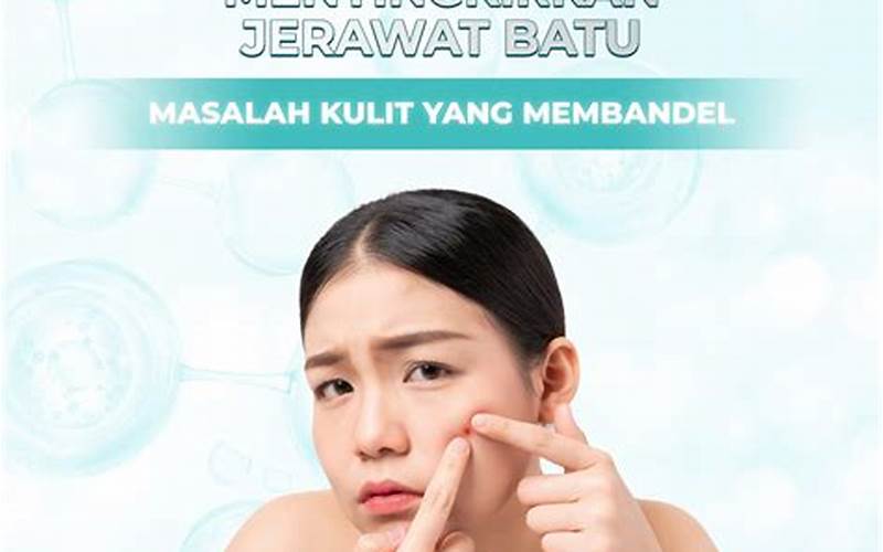 Eskinol Untuk Jerawat - Cara Cepat Menyingkirkan Masalah Jerawat