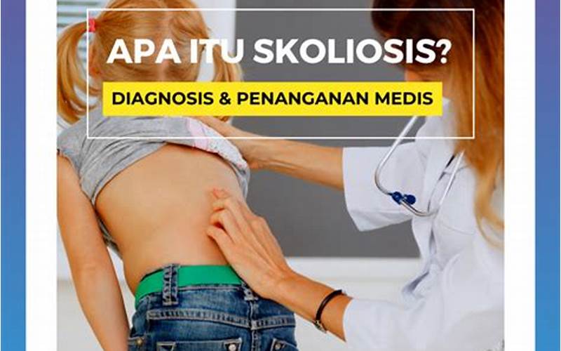 Faq Tentang Penyebab Dan Mengobati Skoliosis Dengan Pilates