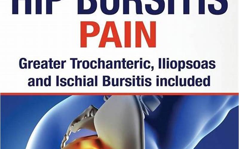 Hip Bursitis Treatment