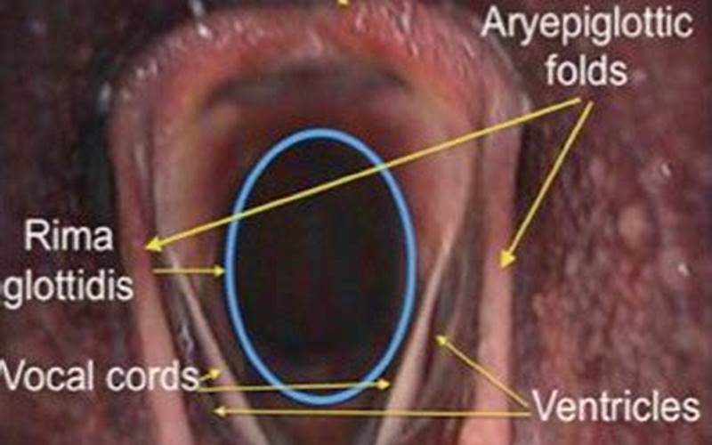 Horse Vocal Cords