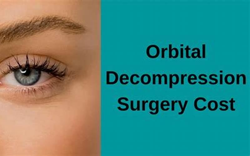 Hospital Facilities Orbital Decompression Surgery Cost