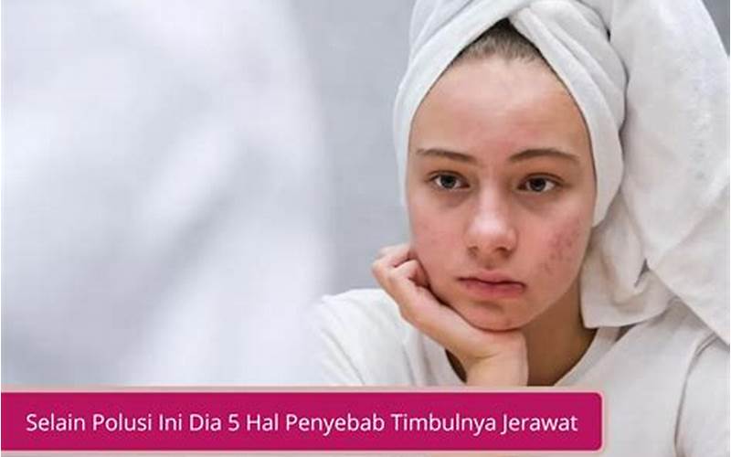 Jerawat: Cara Mengatasi Jerawat Dan Menghilangkannya