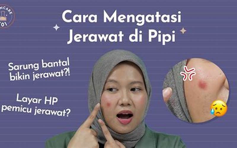 Jerawat Di Pipi Bawah: Cara Mengatasinya?