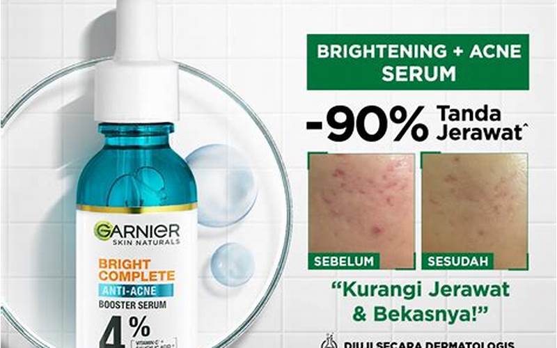 Khasiat Skincare Garnier Untuk Jerawat