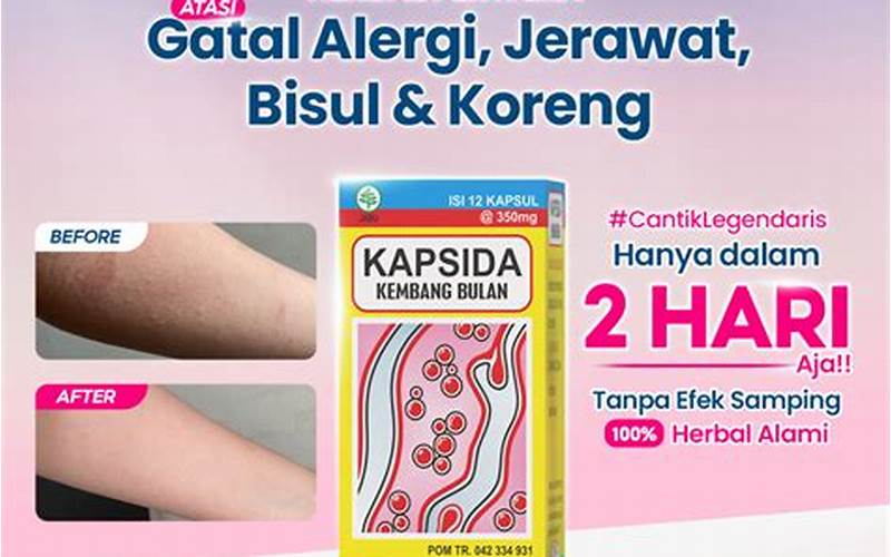 Manfaat Obat Kembang Bulan Untuk Jerawat