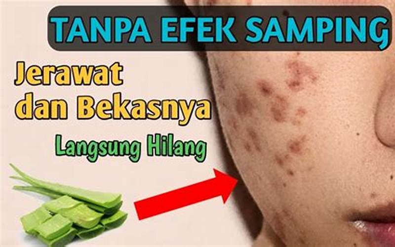 Masker Jerawat Salicylic: Cara Cepat Hilangkan Jerawat Tanpa Efek Samping