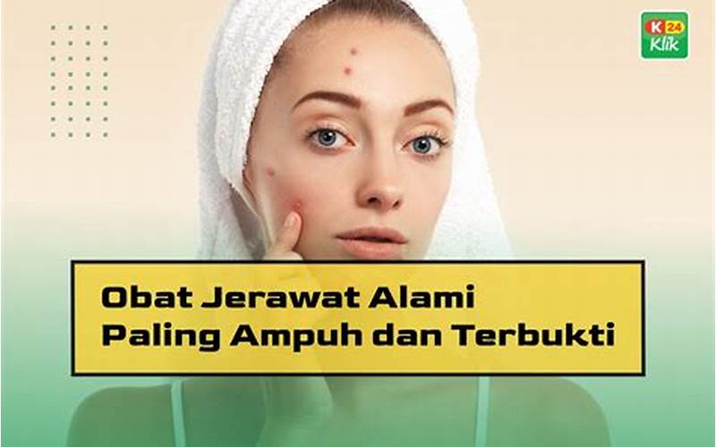 Mengatasi Jerawat Dengan Obat Paling Ampuh