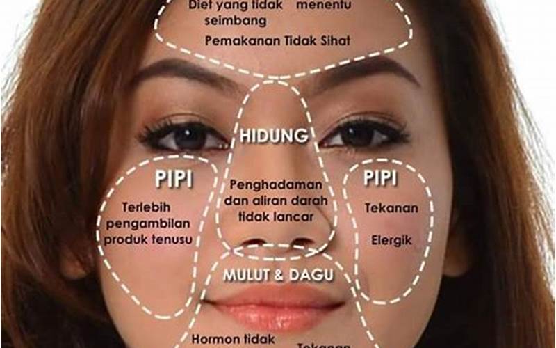 Mengatasi Jerawat Di Muka Sebelah Kanan