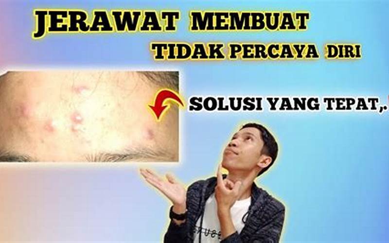 Menghilangkan Jerawat Dengan Bawang Merah