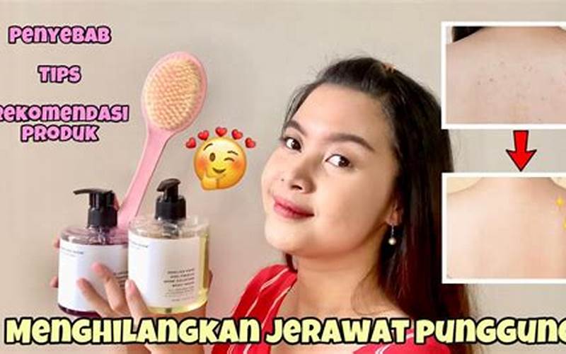 Menghilangkan Jerawat Punggung Dengan Cepat