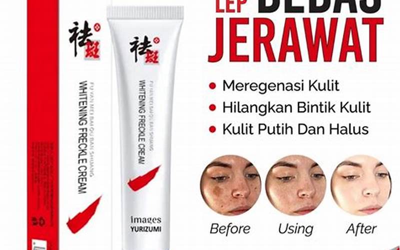 Obat Ampuh Menghilangkan Jerawat Dan Bekas Jerawat