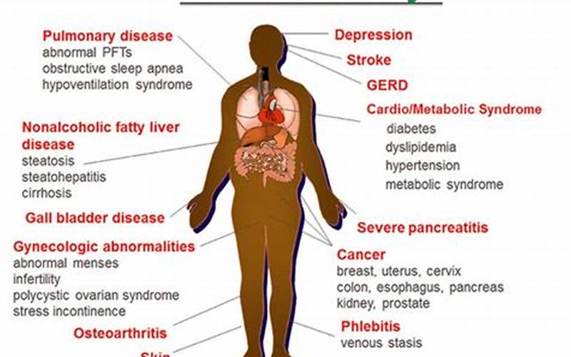 Obesity Risk