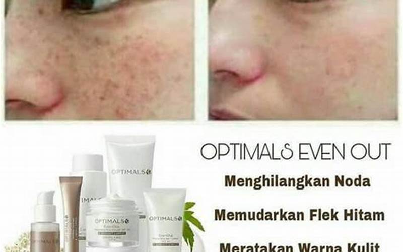 Optimals Oriflame Untuk Jerawat