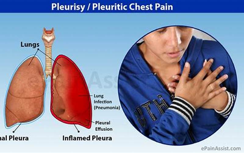 Pleurisy Causes