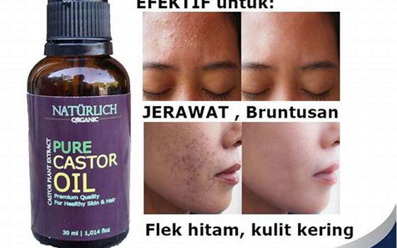 Review Castor Oil Untuk Jerawat