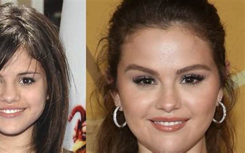Selena Gomez Cat Eye Surgery: What You Need to Know