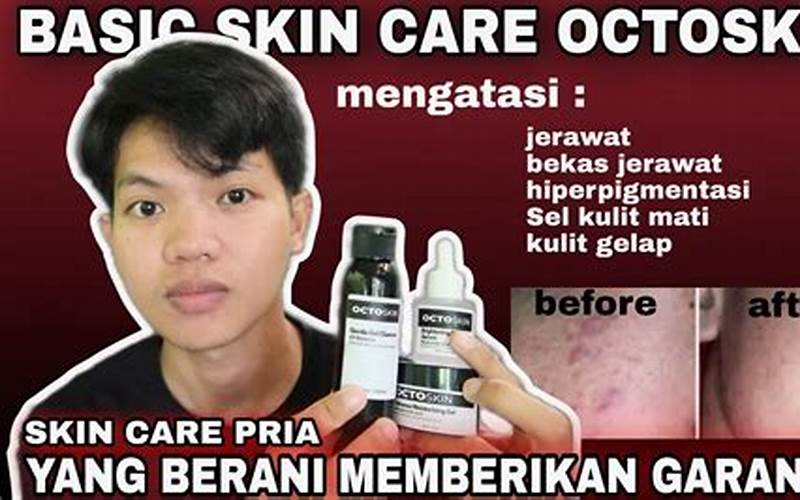 Skin Care Pria Jerawat, Ini Rahasianya!