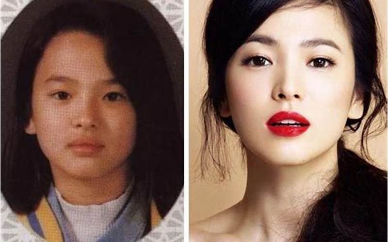 Song Hye Kyo Plastic Surgery: Everything You Need to Know
