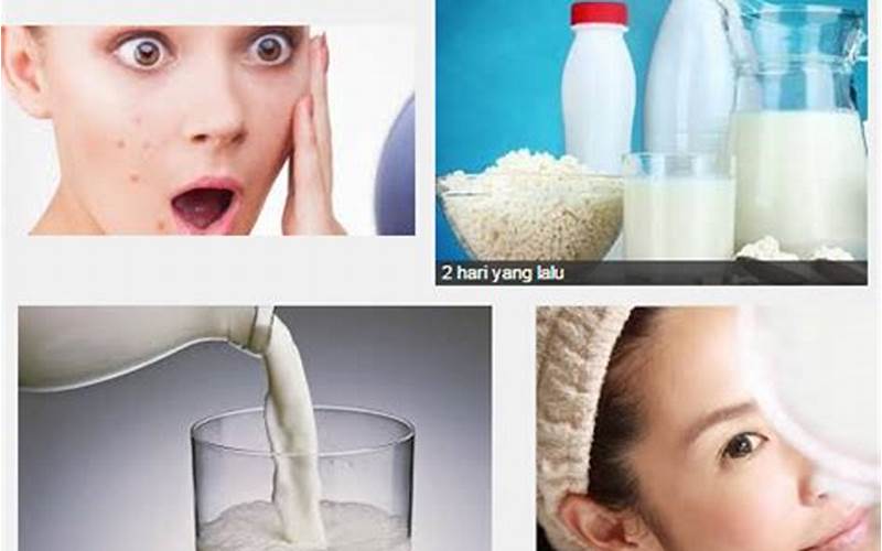 Susu Bisa Menyebabkan Jerawat?