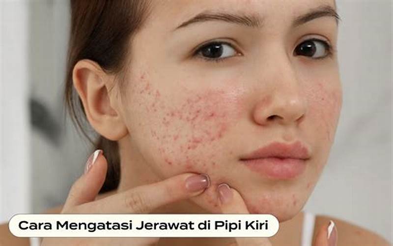 Tanda Jerawat Di Pipi Kiri