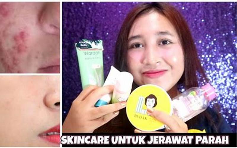 Tips Dan Rekomendasi Skincare Jerawat Murah
