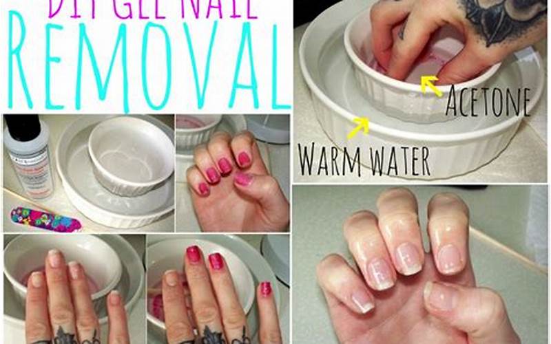 Tips For Successful Nail Removal