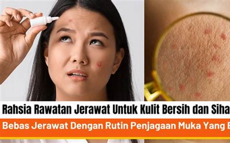 Ubat Jerawat Batu: Rahsia Untuk Bersihkan Kulit Anda