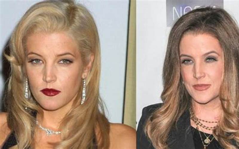 What Kind of Plastic Surgery Did Lisa Marie Presley Have?