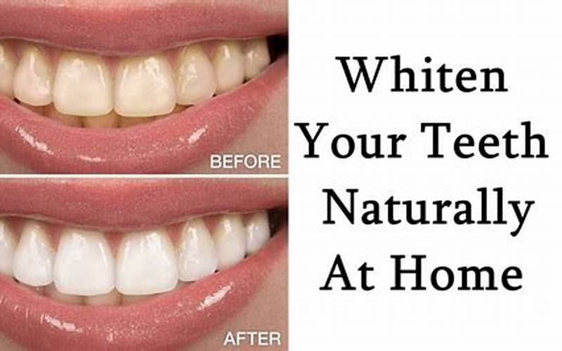 Whitening Teeth With Baking Soda And Aluminum Foil