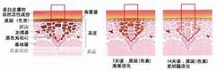 當個白皙女孩～抑制黑色素の傅明酸！＠Jade RUN 潔德快跑｜PChome Online 個人新聞台