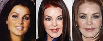 Priscilla Presley Plastic Surgery Before and After Pictures 2022