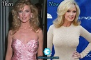 Morgan Fairchild Plastic Surgery, Facelift, Boob Job, Before After Pics ...