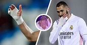 La grande histoire du petit doigt de Karim Benzema - La Meringue ️ ...